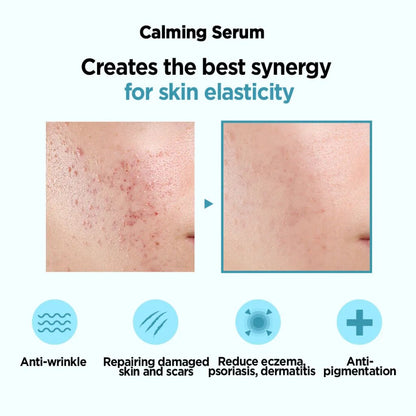 Serum Niacinamide Beauty Of Joseon